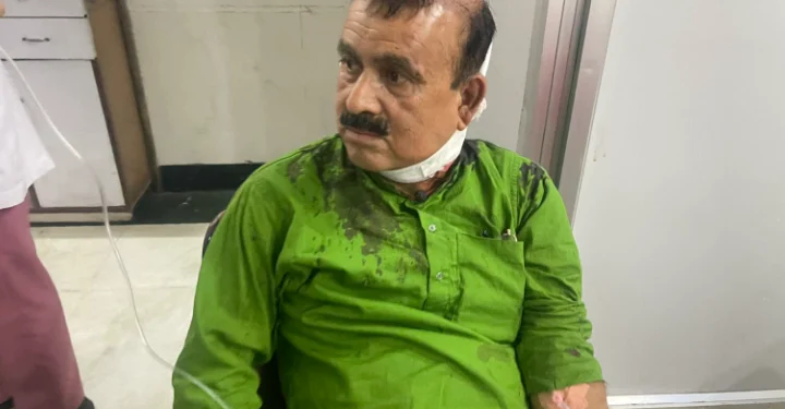 कांग्रेस सहमहामन्त्री महेन्द्र यादवमाथि काठमाडौंमा खुकुरी प्रहार